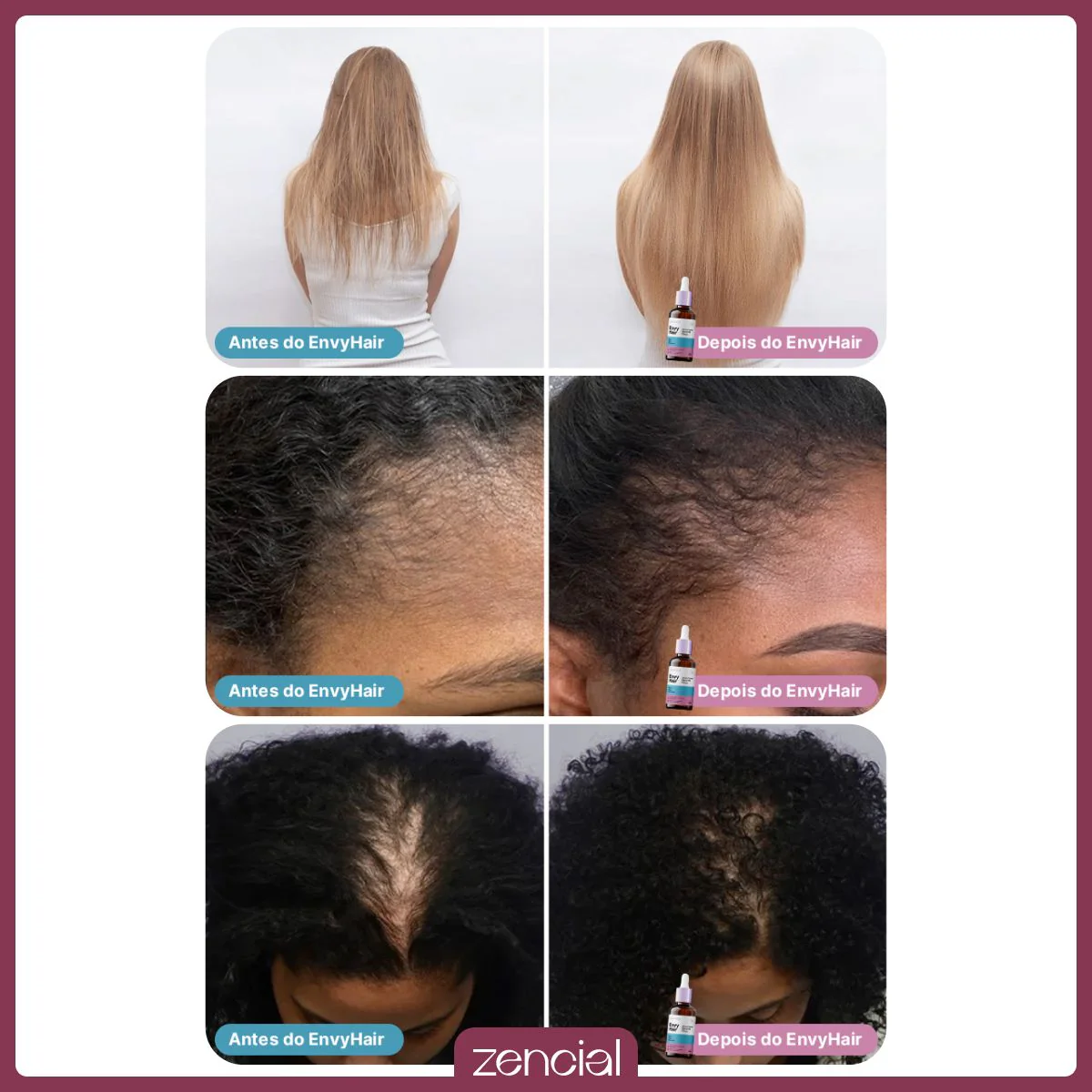 Sérum Capilar Blend de Óleos EnvyHair - Image 3