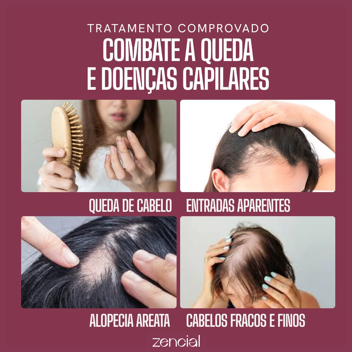 Sérum Capilar Blend de Óleos EnvyHair - Image 4
