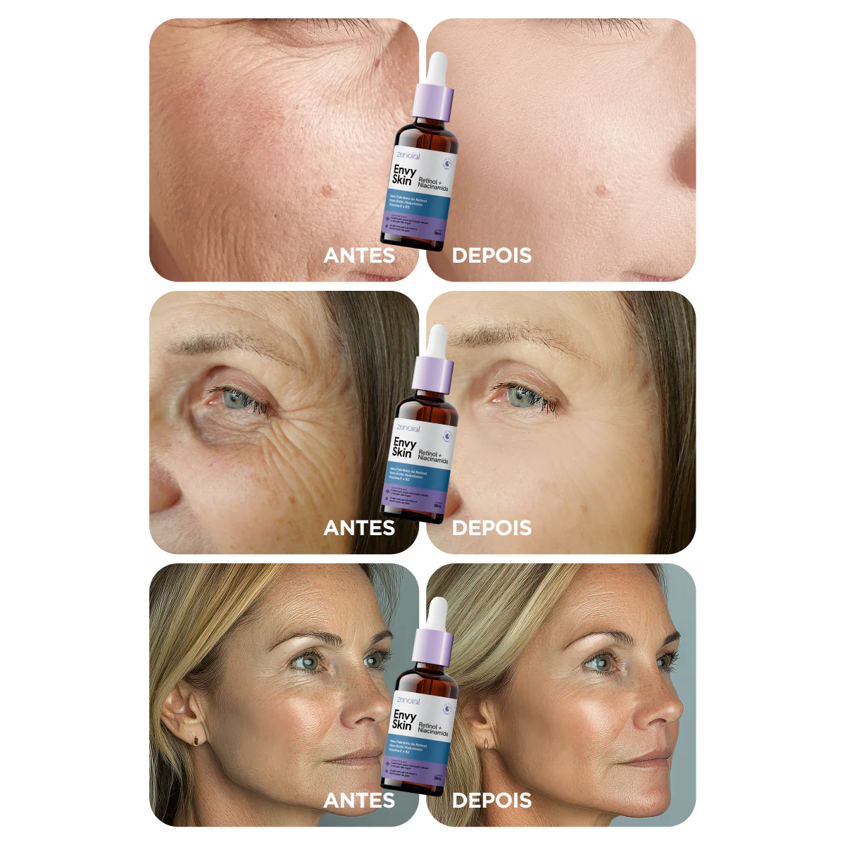 Sérum Anti-Envelhecimento Envy Skin Nano Retinol + Niacinamida 30ml - Image 5