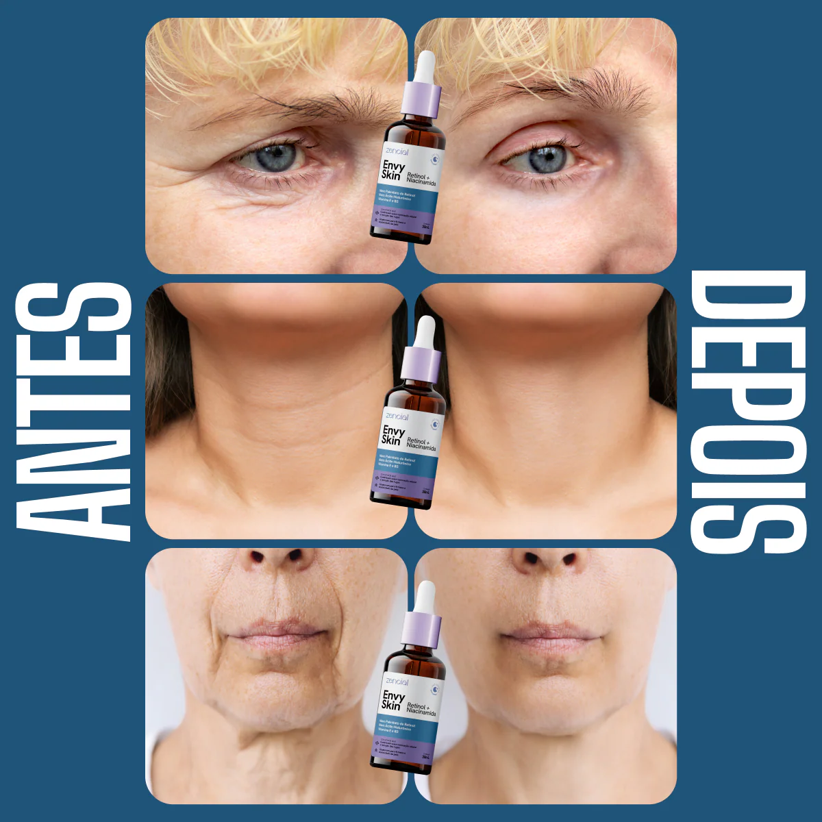 Sérum Anti-Envelhecimento Envy Skin Nano Retinol + Niacinamida 30ml - Image 6
