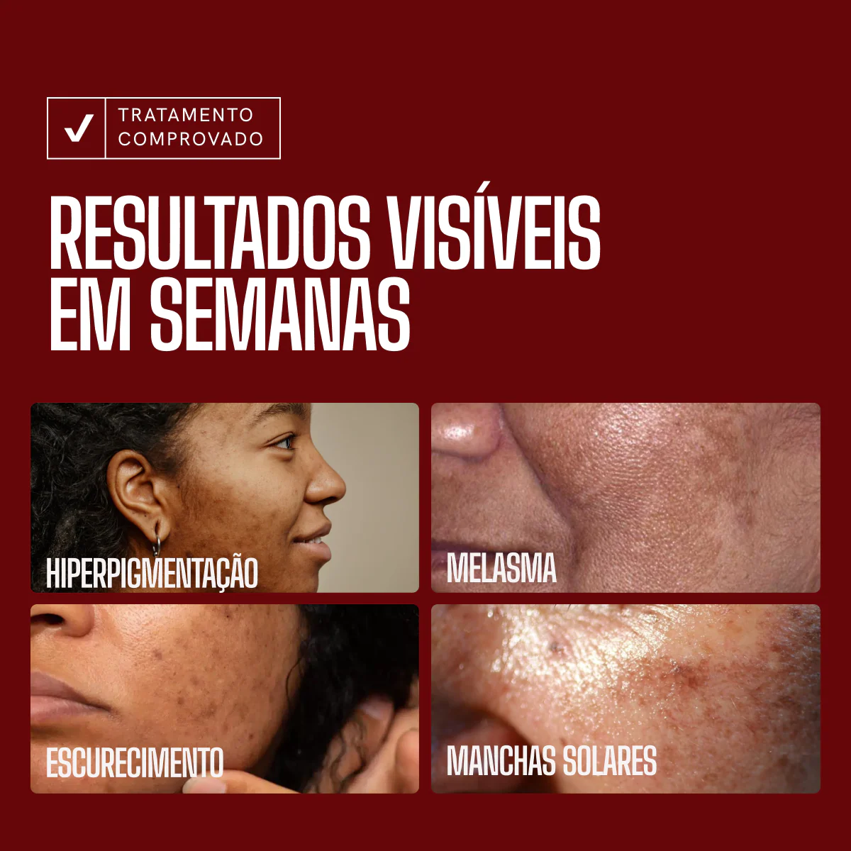 Sérum Clareador Anti-manchas Envy Skin Ácido Tranexâmico - Image 3