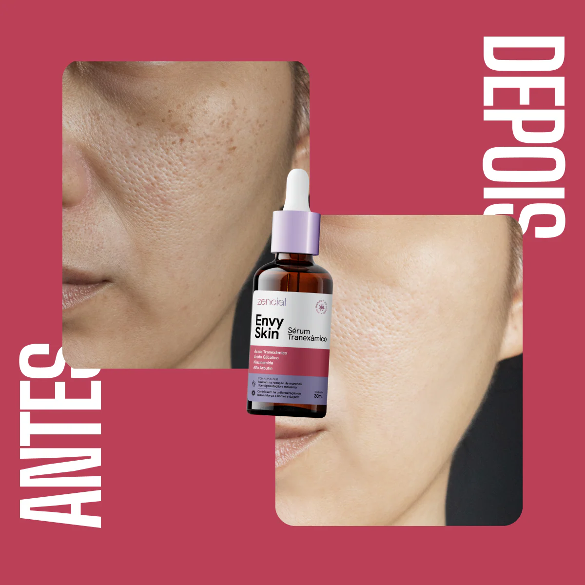Sérum Clareador Anti-manchas Envy Skin Ácido Tranexâmico - Image 4