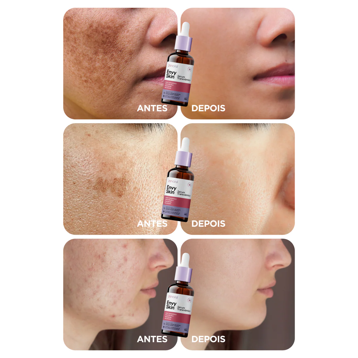 Sérum Clareador Anti-manchas Envy Skin Ácido Tranexâmico - Image 7